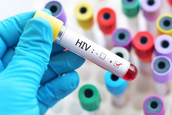  người mắc giang mai có nguy cơ nhiễm HIV